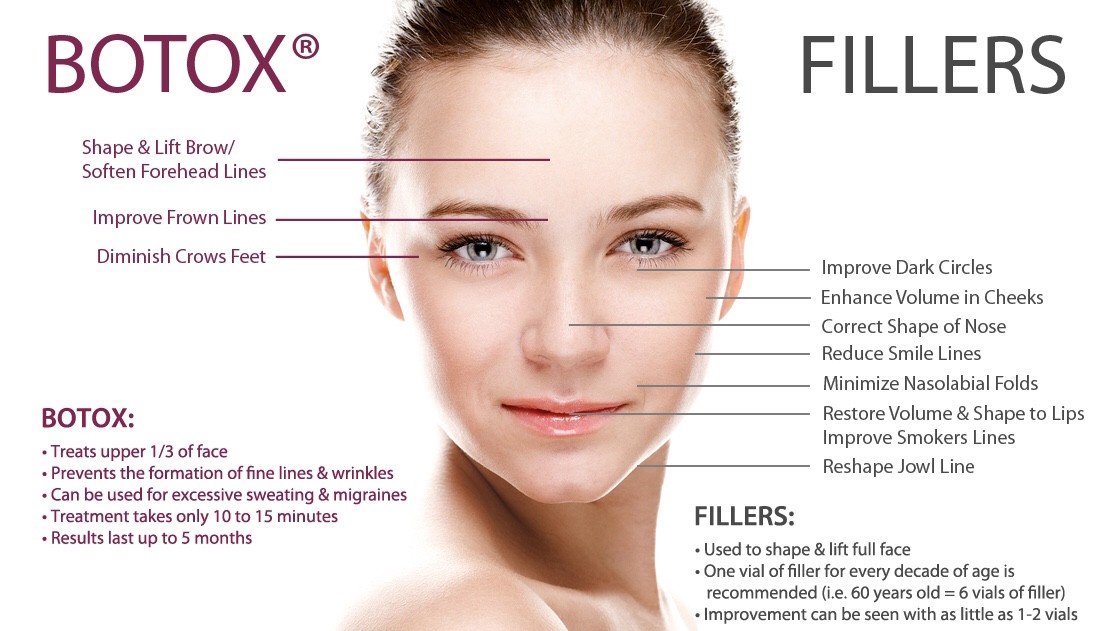 Botox and Fillers